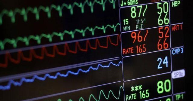 Blood thinners no longer needed for many with irregular heatbeats, study suggests