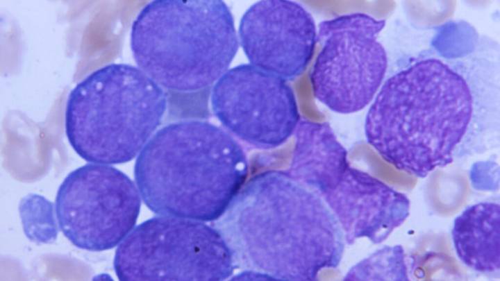Kura Oncology secures approval for leukemia drug, its first
