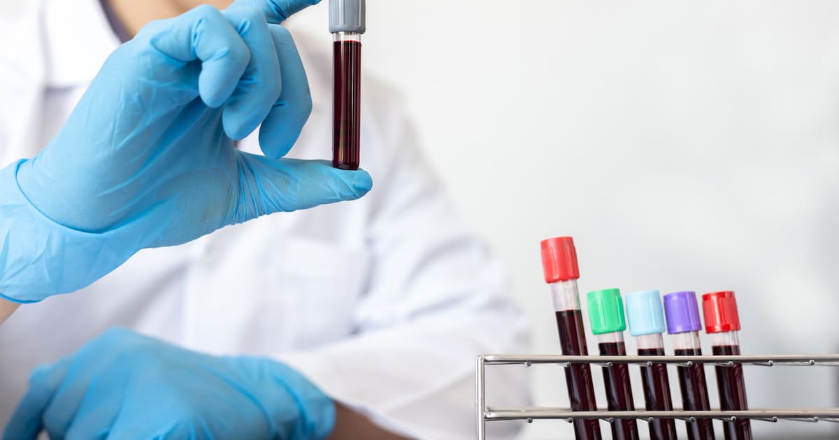 Conoce cuáles son los grupos sanguíneos más comunes y los más escasos, su importancia en la logística hospitalaria y cómo influye cada tipo en el riesgo de trombosis, compatibilidad y emergencias médi