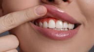 IOC Clínica Dental: soluciones profesionales para la salud de tus encías y dientes