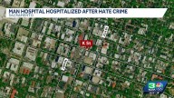 Man arrested in hate crime attack in Midtown Sacramento, police say