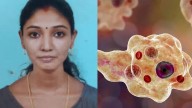 26-year-old woman dies of brain eating infection in capital city; source of disease unclear