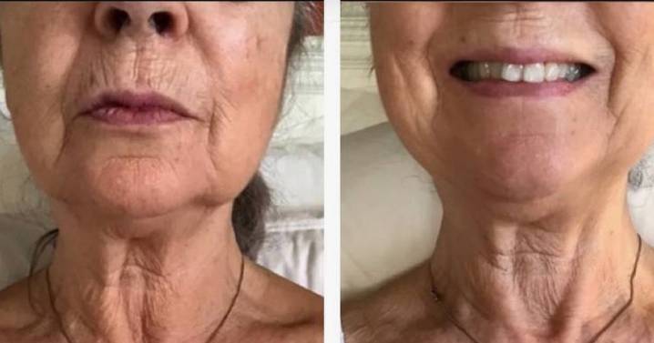 67-year-old 'loves' £23 anti-wrinkle neck cream that 'smooths out lines'