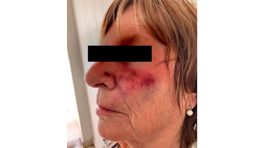 Violento asalto en Mar del Plata: golpearon a una jubilada y atropellaron a su hija al escapar