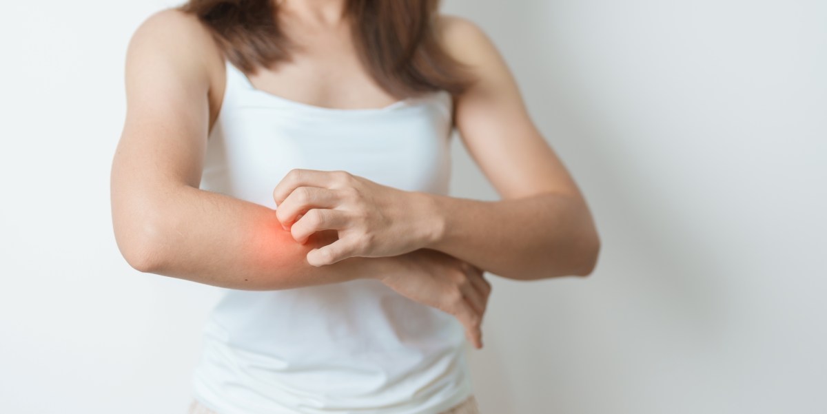 Los casos de lupus podrían estar relacionados con virus que afecta al 95% de las personas