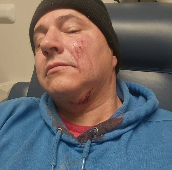 Healthy Hearts and Paws CEO attacked by 'neglected dog'