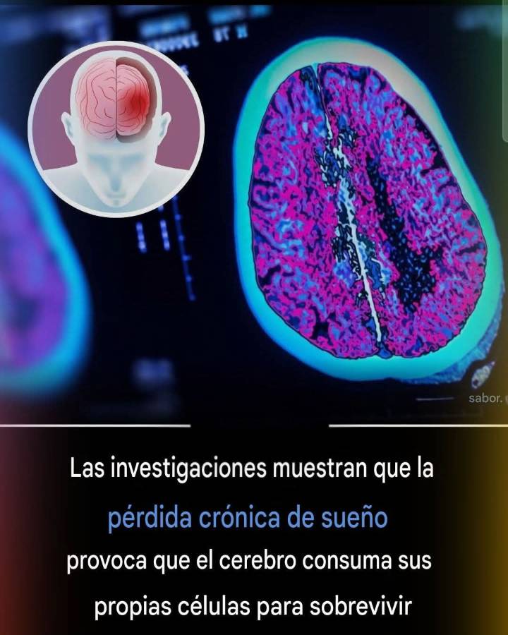 Dormir no es un lujo Es un requerimiento biológico que protege el cerebro de la ruptura