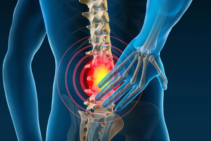 When Ordinary Back Pain Signals Something Serious: Early Signs You Could Be Facing a Slipped Disc