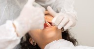 Wisdom Tooth Surgery? Opioids Not Necessary, Clinical Trial Finds