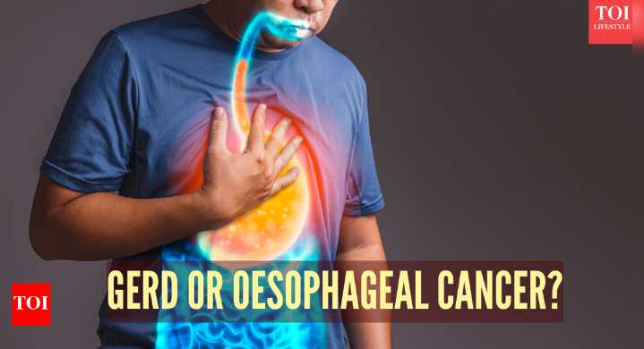 Esophageal cancer vs GERD: Symptoms, causes, and key differences