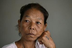 Nepal’s war victims watch political changes with fragile hope