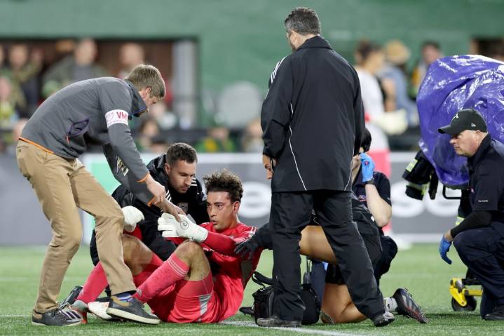 SDFC goalie suffered fractured cheekbone in Saturday's playoff loss