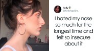 Women Are Posting Their Noses That Look Like “Before” Photos