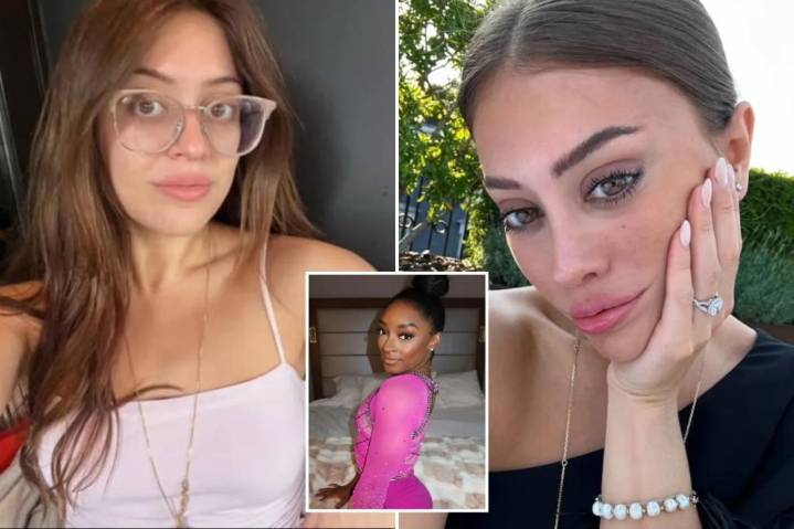 Exclusive | Women under 30 opting for major plastic surgery, alarming experts