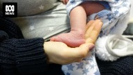 Hundreds of Queensland babies may have missed vital newborn blood screening tests
