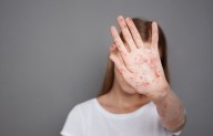 New Measles Spread Across States Threatens U.S. Elimination Status