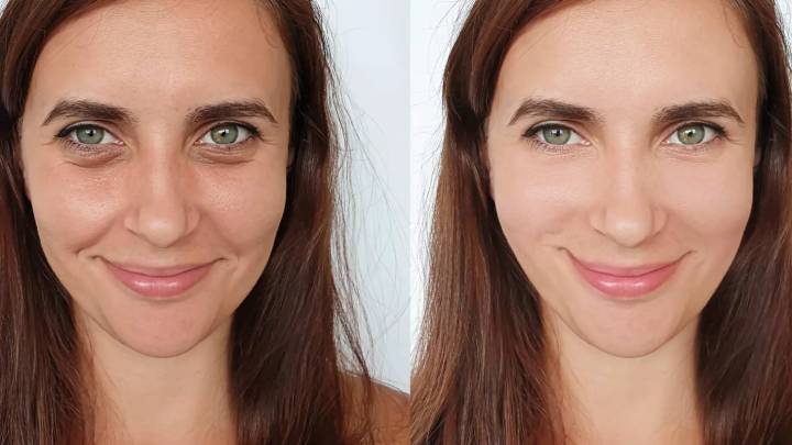 Cómo utilizar vinagre de manzana para suavizar las líneas de expresión de manera natural y conseguir un rostro más joven