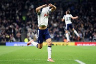 Tottenham tackle lack of cover with hair transplant partner Elithair