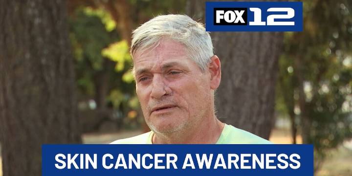 Untreated skin cancer leads to 9-hour facial surgery for Oregon construction worker