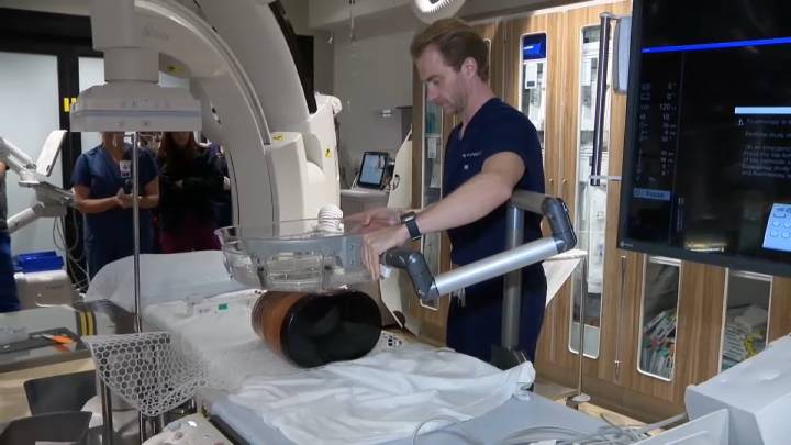 Sharp Memorial Hospital introduces cutting technology to kill cancer tumors