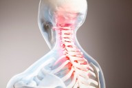 Long-Term Morbidity, Mortality Increased After Traumatic Spinal Cord Injury