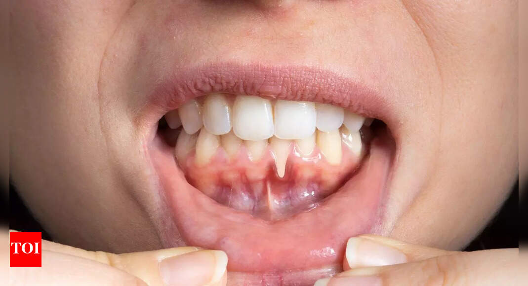 8 health problems that show up in your teeth and gums: What your smile reveals about your wellness