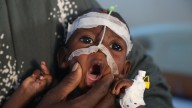 A visit to Somalia's crumbling hospitals shows the toll of aid cuts and war