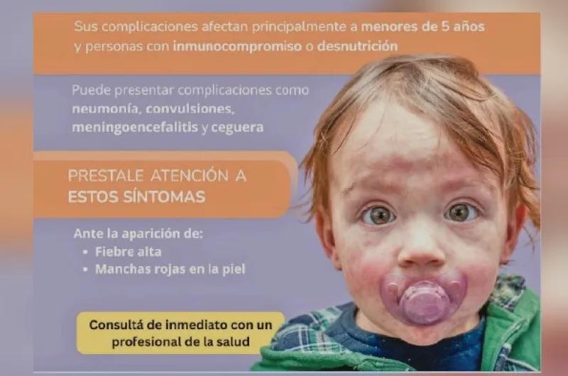 Alerta sarampión: el Ministerio de Salud de Santiago pide completar el carnet de vacunación