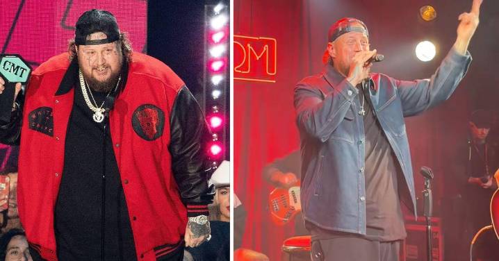 Jelly Roll's 'Excess Skin Removal' Explained By Top Plastic Surgeon