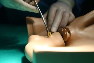 ¿La vasectomía afecta la potencia masculina? Llama al Línea 113 y absuelve tus dudas