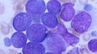 Kura Oncology secures approval for leukemia drug, its first
