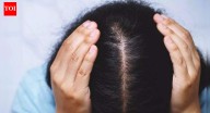 7 Home remedies for dry scalp in winter: Natural solutions to hydrate, soothe, and reduce flakes