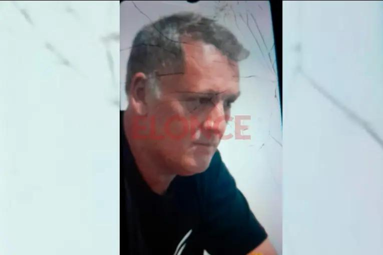 Defensor de acusado de balear a su pareja pidió una pericia psiquiátrica para determinar su imputabilidad