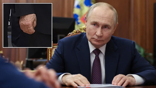 Putin’s ‘swollen hands’ and ‘bulging veins’ spark renewed health speculation