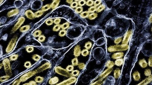 1st human known to be infected with H5N5 strain of bird flu dies