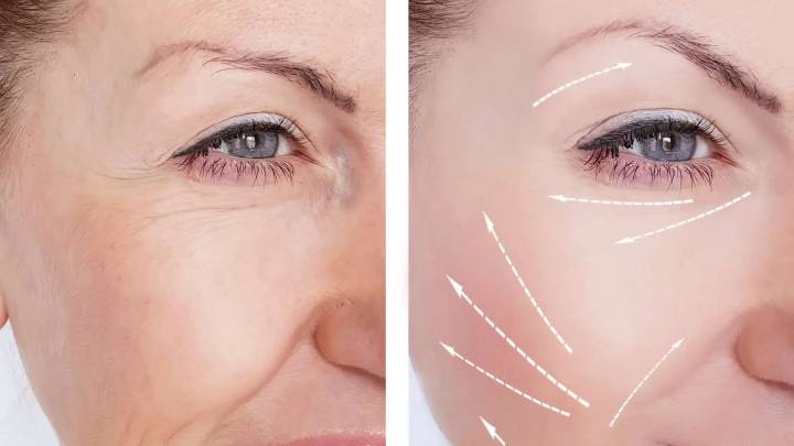 Cómo utilizar vinagre de manzana para suavizar las líneas de expresión de forma natural y tener un rostro más joven