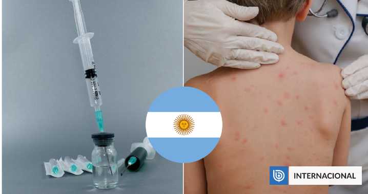 Alerta en Argentina: vacunación se desploma a menos del 50% de la población y hay brotes de sarampión