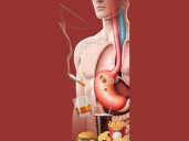 Cáncer gástrico se adelanta a los 50 años; 80% lo confunden con gastritis