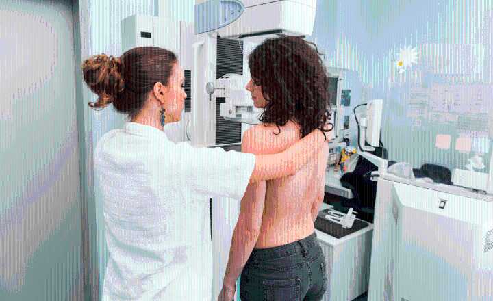 Mamografía: Estudio esencial en un programa preventivo