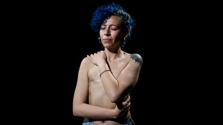 En la Fila por Vivir, Mujeres con Cáncer de Mama Esperan Meses por Tratamiento