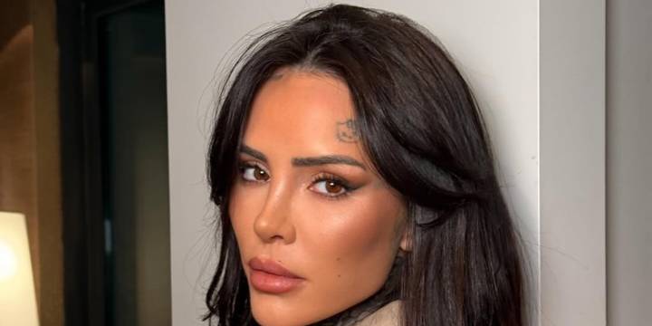 El emotivo posteo de Cande Tinelli con su perrita en medio de su recuperación: “Rotas pero juntas”