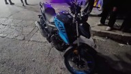 Joven motociclista termina con pierna destrozada tras ser embestido por automovilista