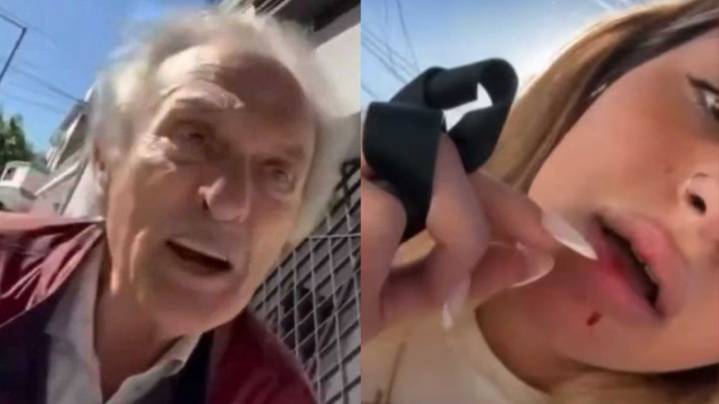 "Me pegó una piña con la llave": un jubilado atacó a una joven por estacionar cerca de la salida de su garage