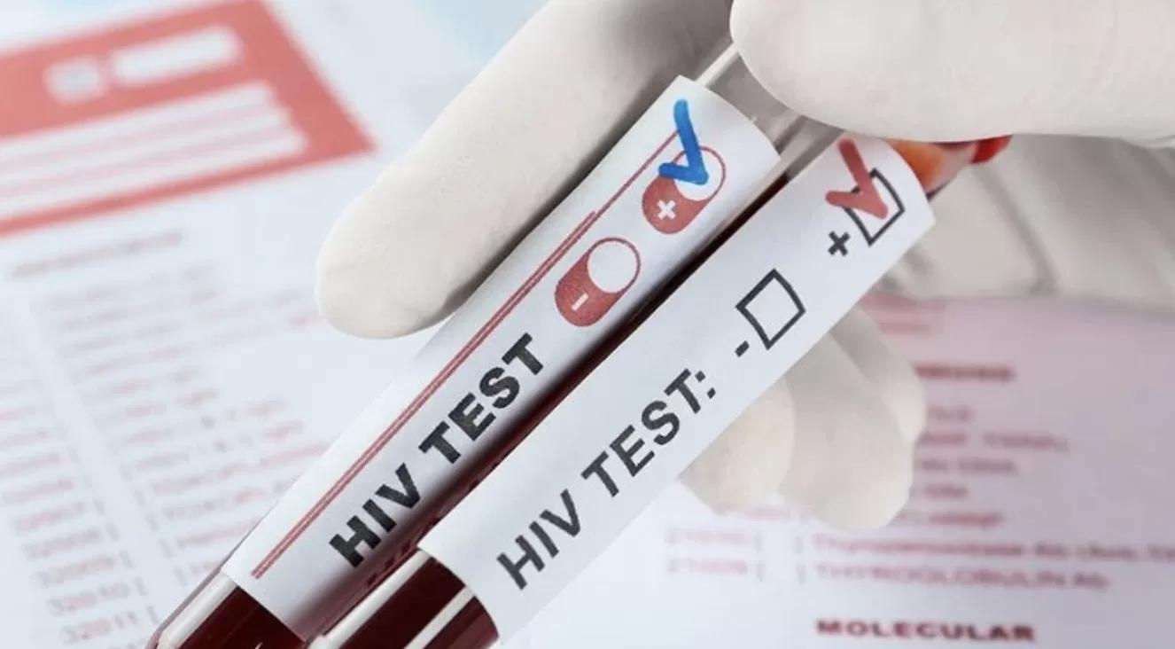 MÉXICO registró más de 15 mil nuevos casos de VIH durante 2025