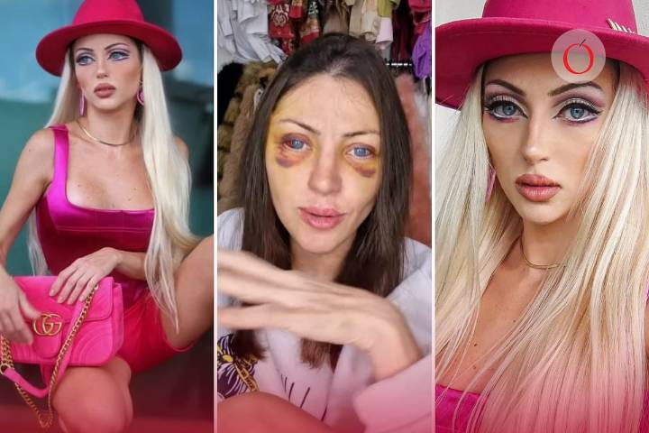 Muere la “Barbie humana”, Bárbara Jankavski, tras someterse a más de 27 cirugías estéticas