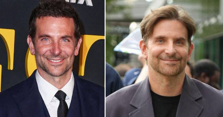 Bradley Cooper’s Plastic Surgery Disaster! Inside His Bizarre New Look