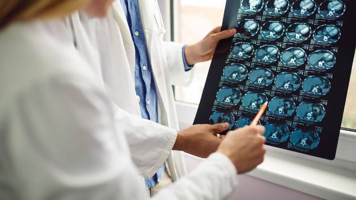 Cambios en la asistencia tras un ictus