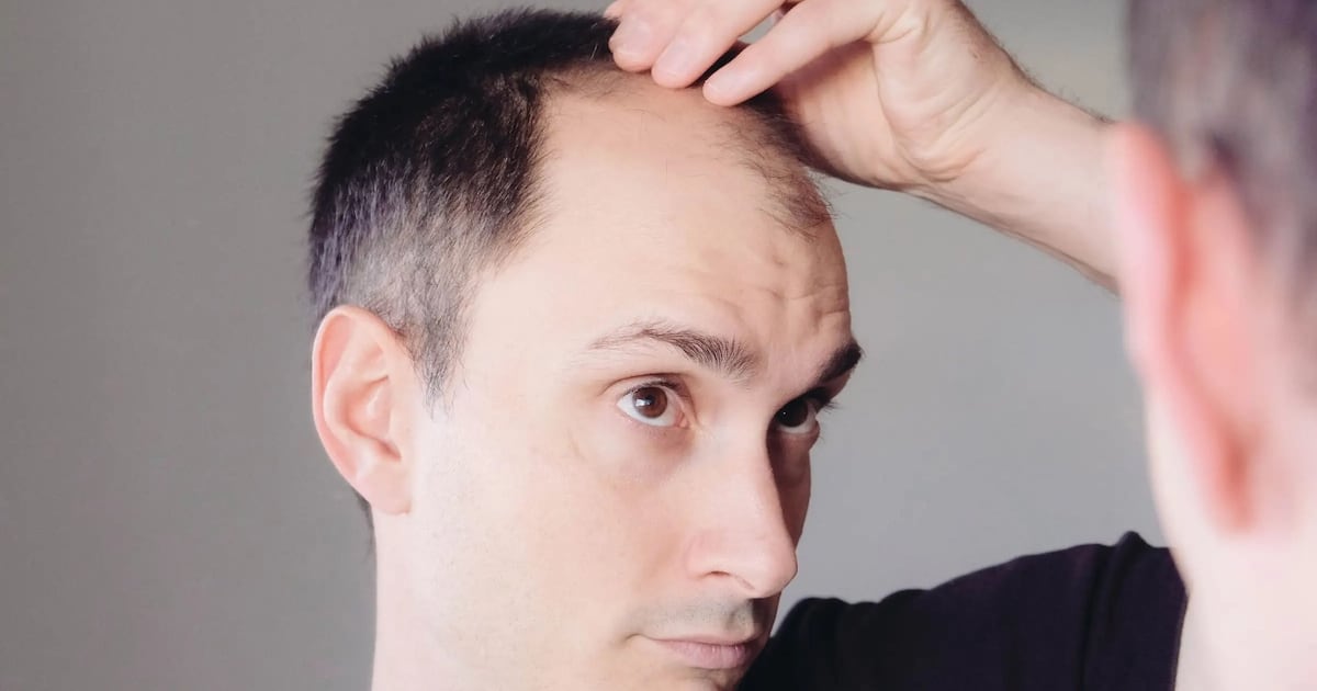 3 razones por las que puedes tener caída de pelo