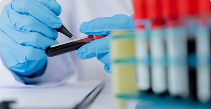 En 2023, más de 4 mil personas recibieron atención y tratamiento contra VIH en el Meta