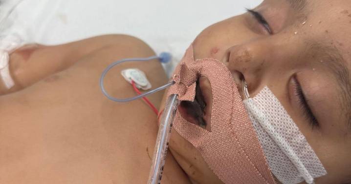 Baby had heart attack and lost tongue after drinking from white bottle